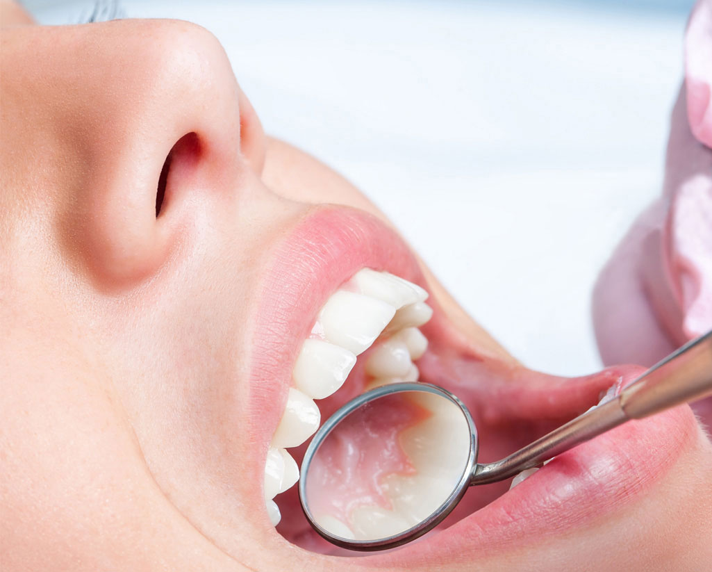 professionelle Zahnreinigung Zähne werden sich angeschaut